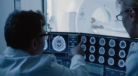 直肠癌术后泌尿生殖功能障碍的原因及预防策略