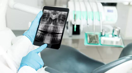 哪些人群需要高度警惕结肠癌的发生