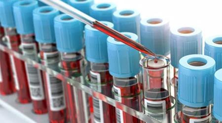 冈上肌损伤不能做哪些运动